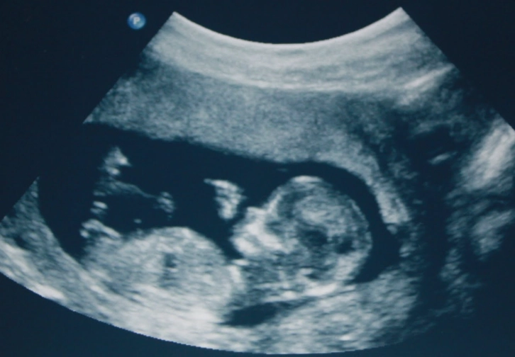 baby at 12 weeks