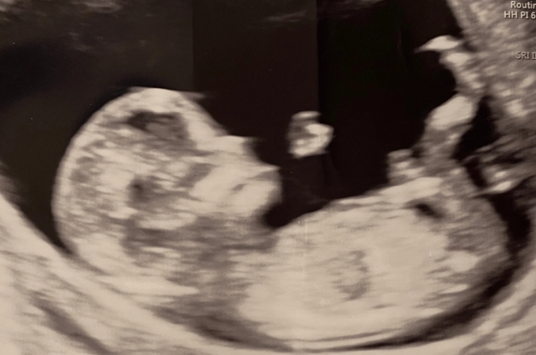 first trimester pregnancy