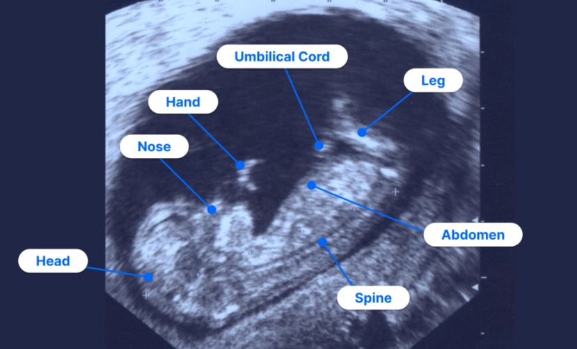 ultrasound report explained