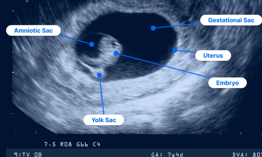 ultrasound report explained