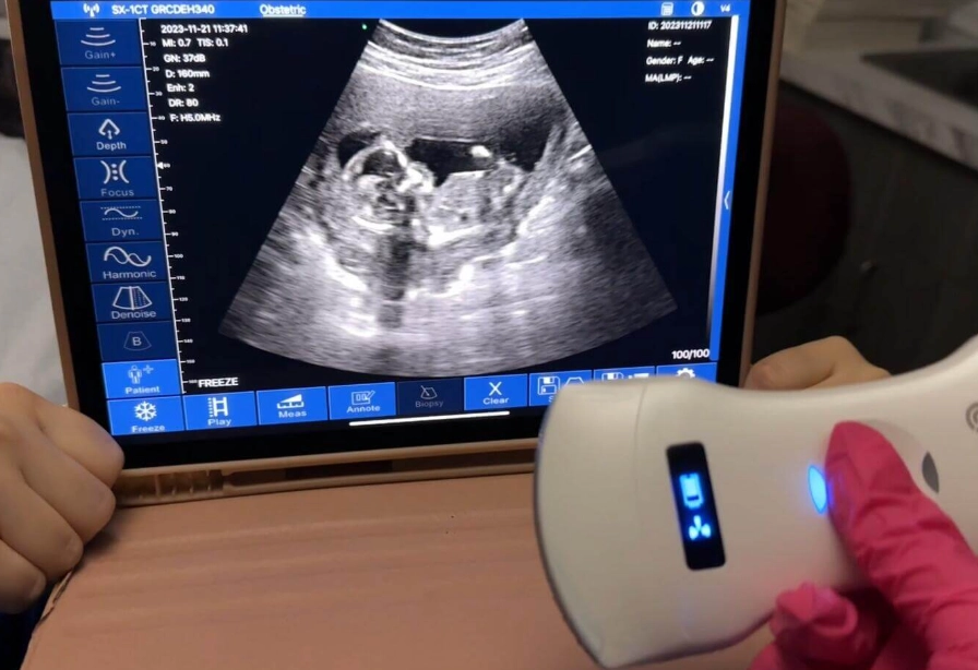 understanding ultrasound scan results