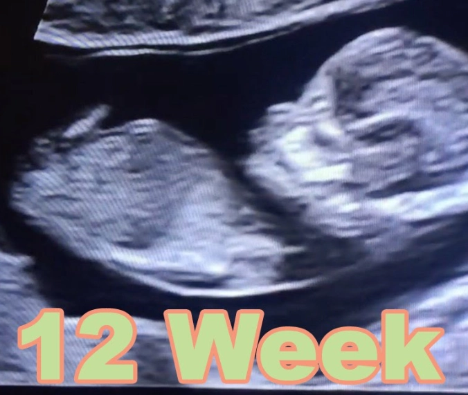 second trimester symptoms