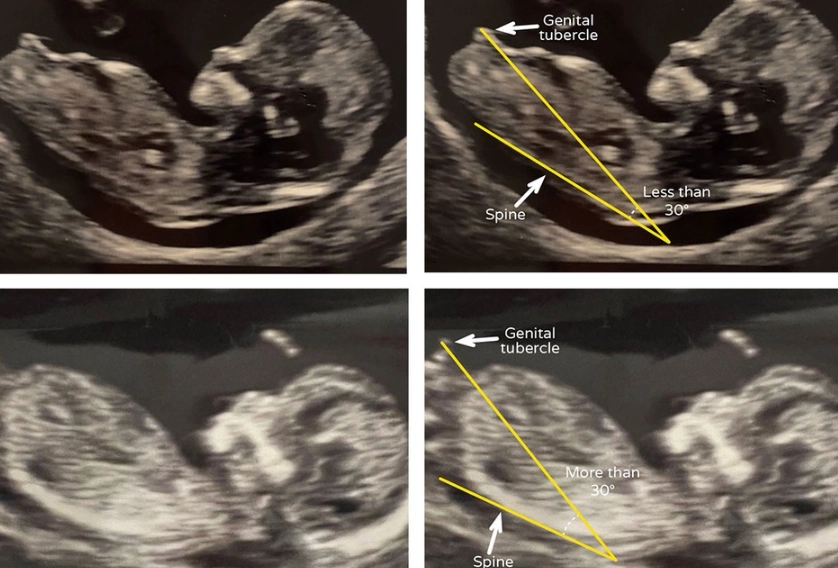 12 weeks pregnant baby movement 12 weeks pregnant baby movement