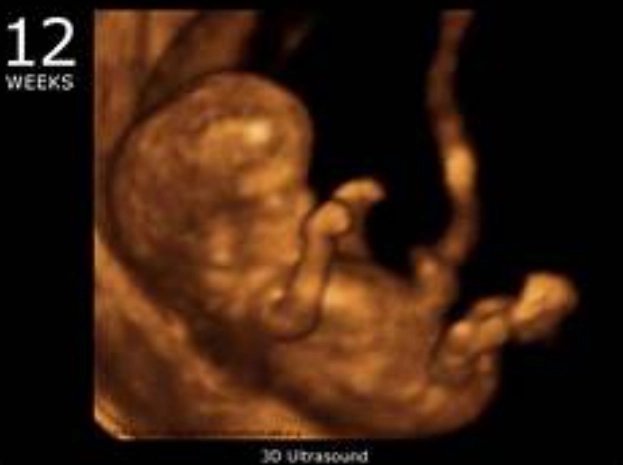 second trimester symptoms