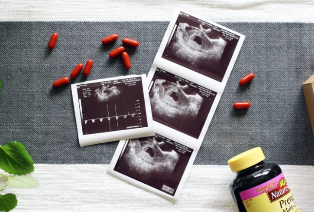 best vitamins before pregnancy