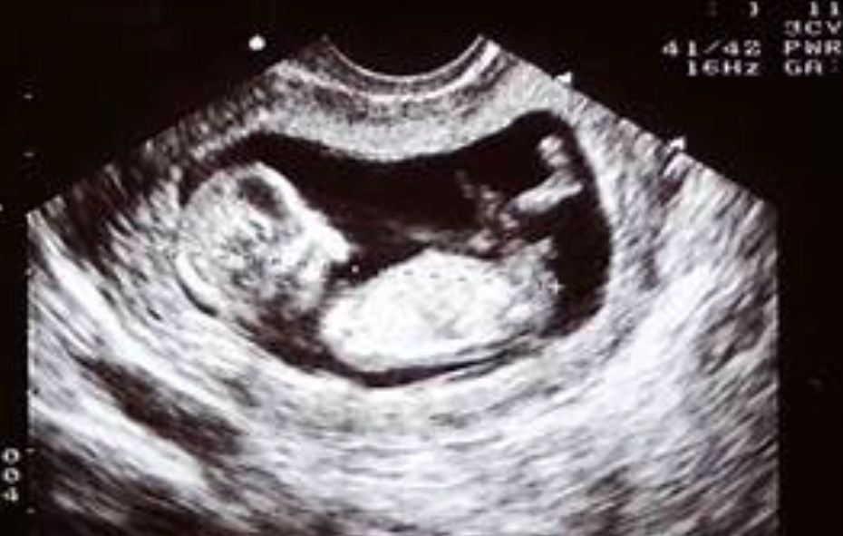 pregnancy weeks vs months