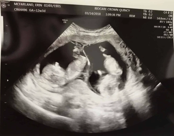 12 weeks pregnant 3 months