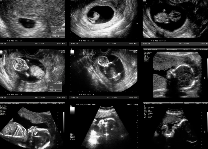 are you 3 months pregnant at 12 weeks