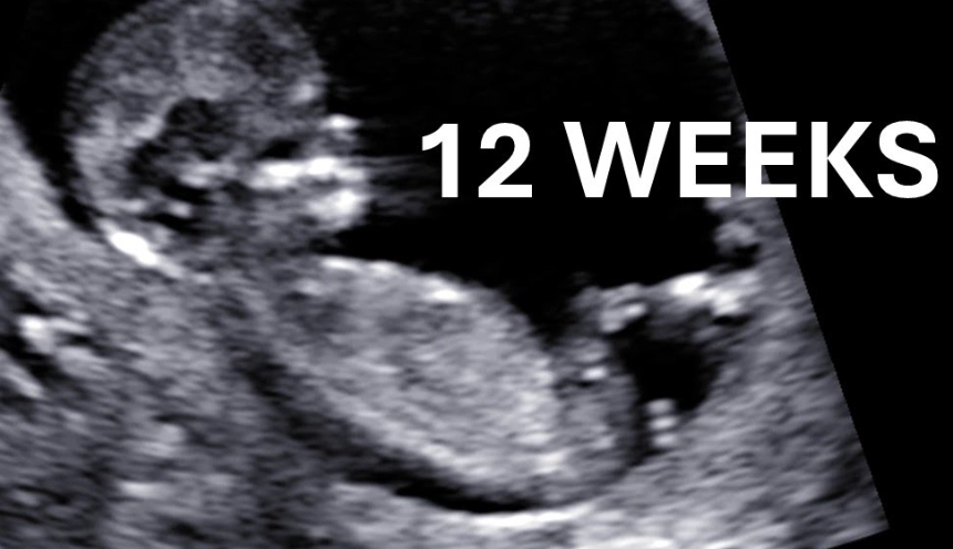 12 weeks pregnant belly