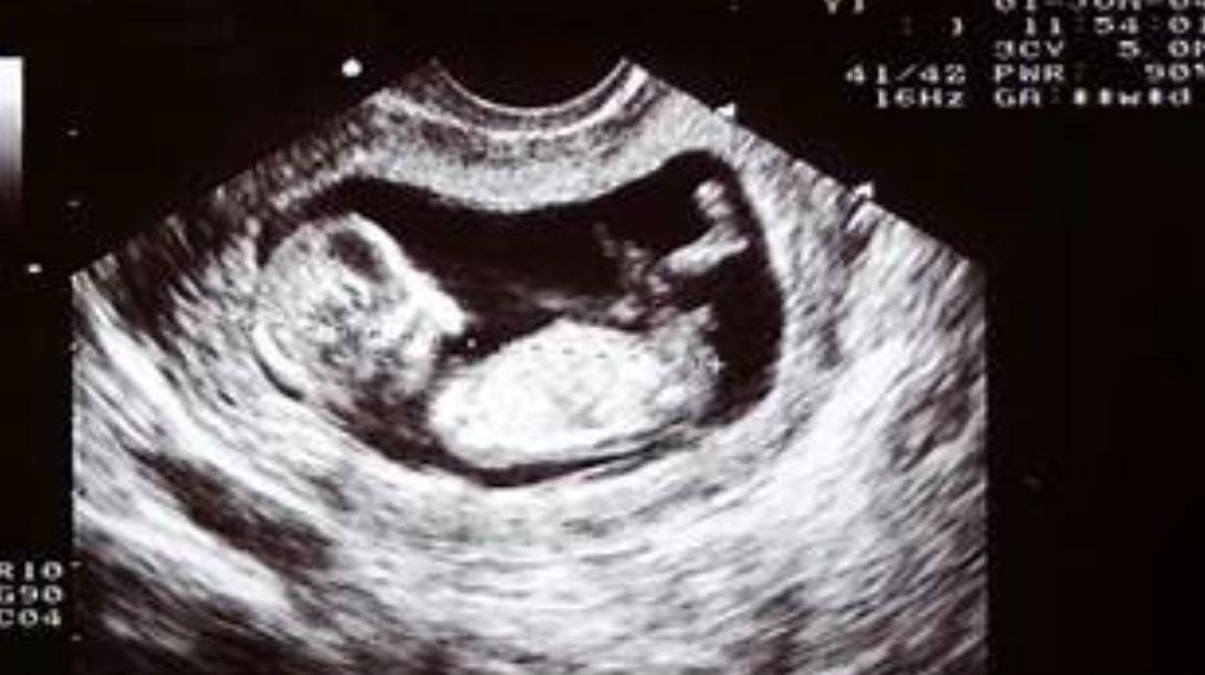 how does your belly look at 12 weeks pregnant