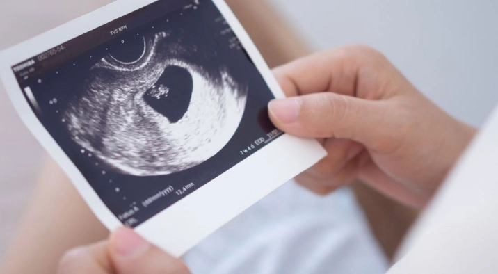 pregnancy report explained