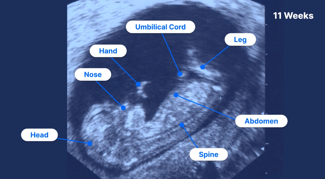 early pregnancy development