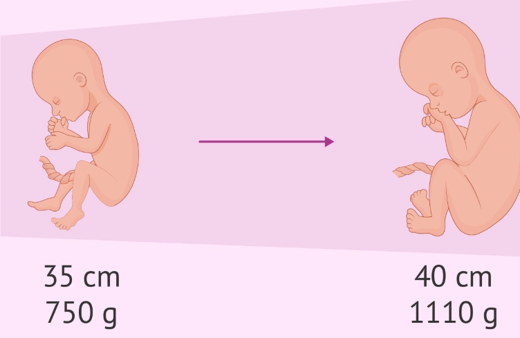 early pregnancy symptoms