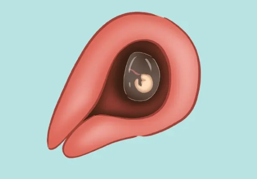 4 weeks pregnant symptoms