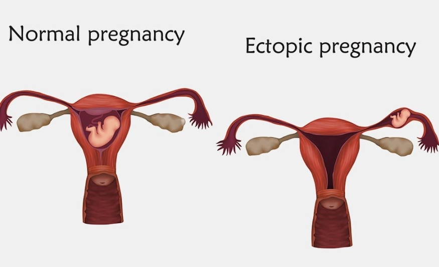 pregnancy symptoms first week