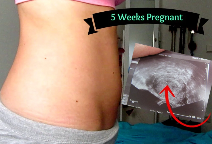 early pregnancy stomach feelings