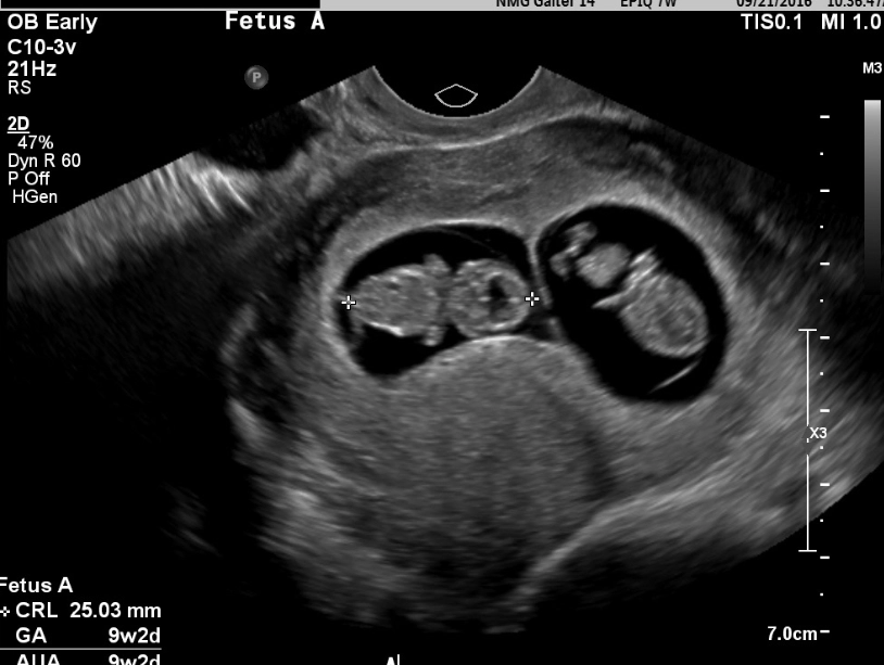 healthy pregnancy tips healthy pregnancy tips