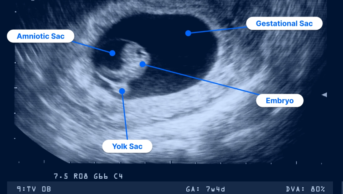 early pregnancy first week