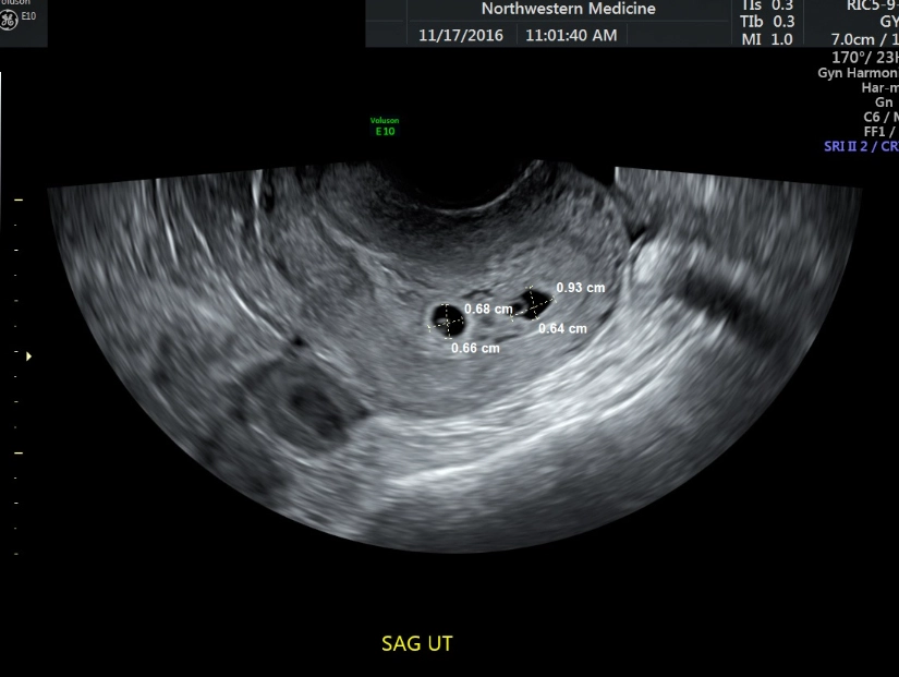 first trimester development
