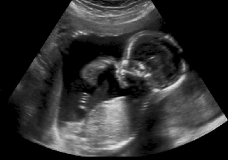 third trimester warning signs