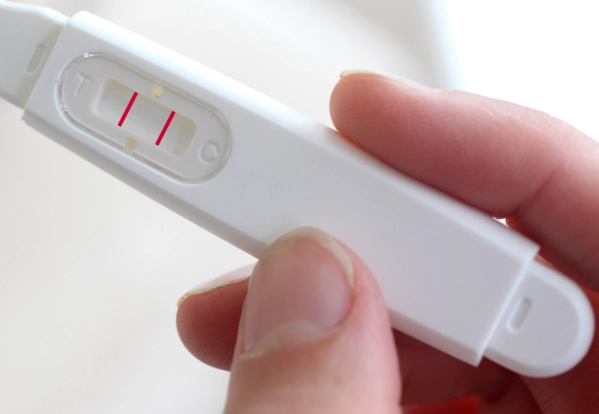 pregnancy gingivitis pregnancy gingivitis