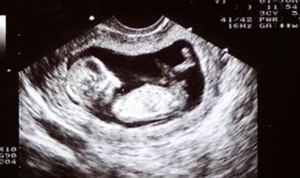 early pregnancy symptoms early pregnancy symptoms