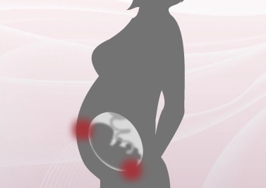 managing pregnancy symptoms
