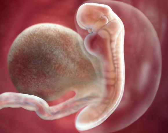 5 weeks pregnant symptoms