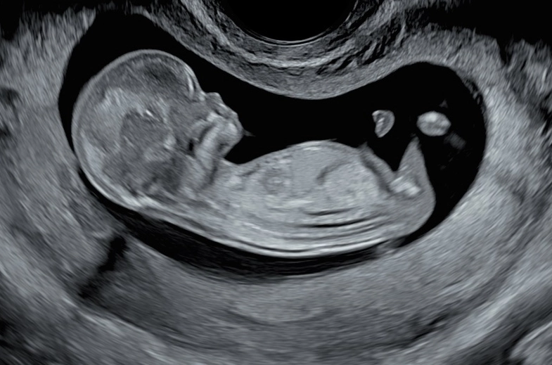 fetal movement patterns