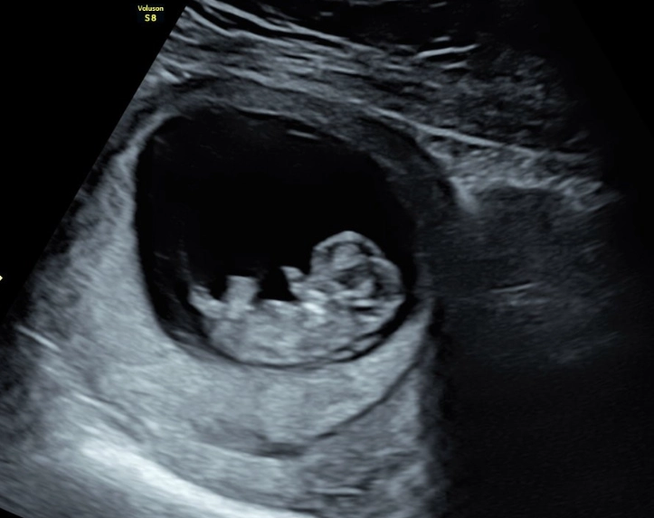 signs of a normal pregnancy