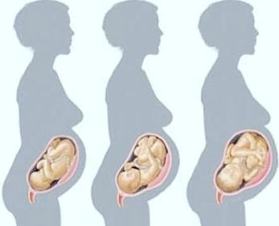 early pregnancy signs