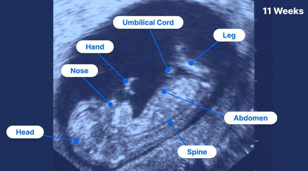 How do you feel 5 days pregnant?