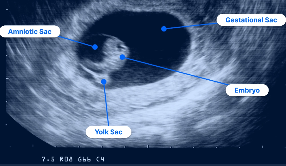 early pregnancy symptoms 4 days