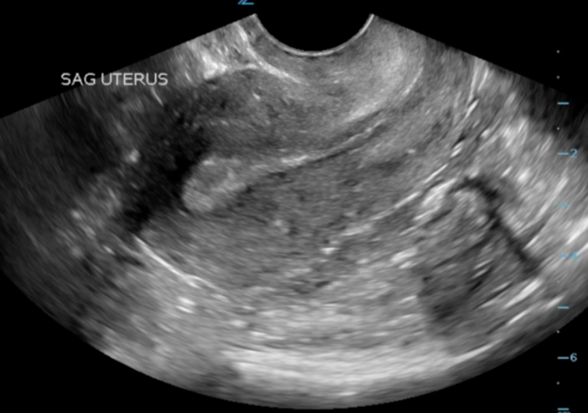 signs of pregnancy by touch signs of pregnancy by touch