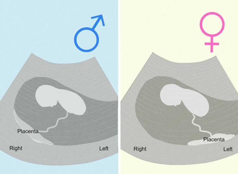 1 month pregnant signs