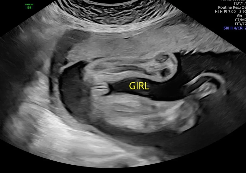 pregnancy week by week