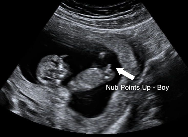 fetal development 12 weeks fetal development 12 weeks
