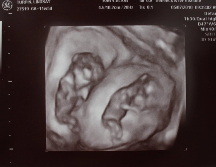 Where is the baby located in 12 weeks?