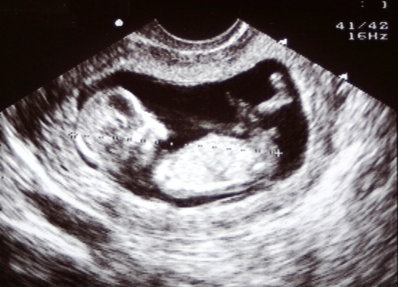 pregnancy months calculator