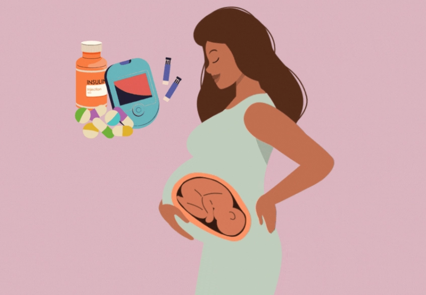 What are the three types of pregnancy?