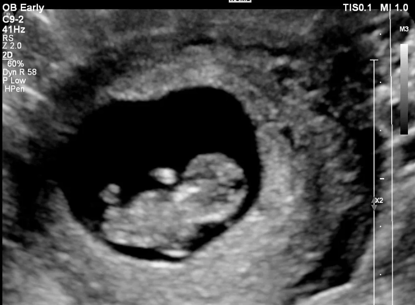 3 months pregnant in weeks 3 months pregnant in weeks