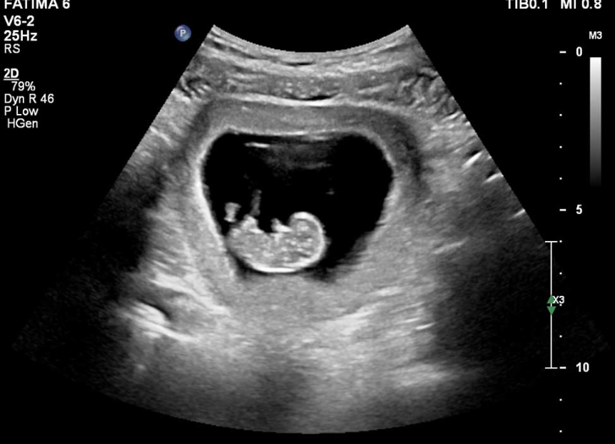 pregnancy months calculator