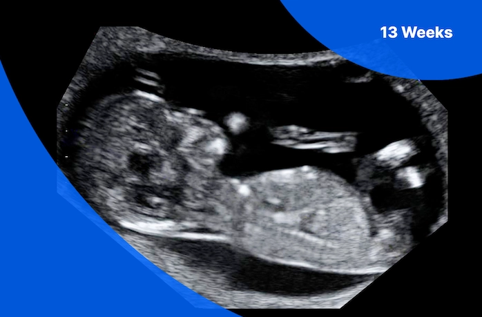 healthy pregnancy first trimester