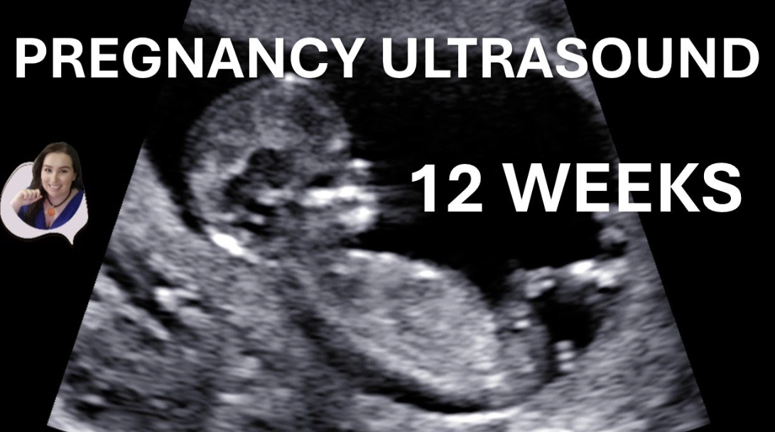 first trimester symptoms