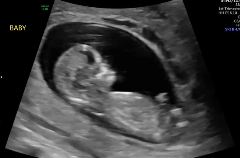 early fetal movement second pregnancy